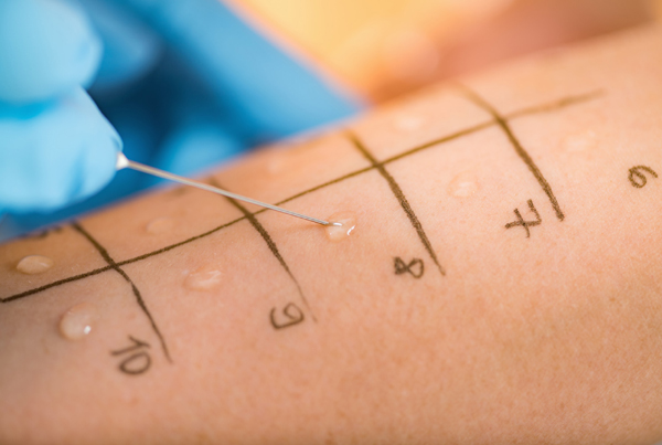 Allergy Testing and Immunotherapy